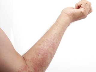 ʪ���֢״����